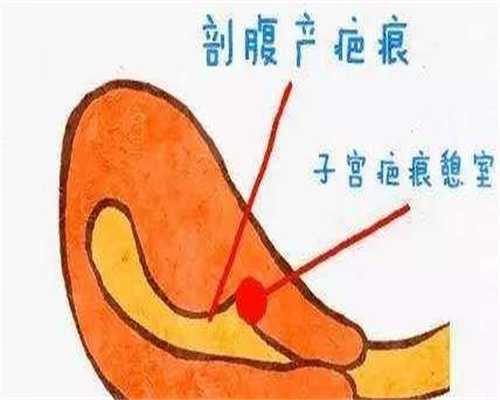 代怀包出生流程_长沙哪里可以供卵吗,长沙试管生子机构名单-长沙试管婴儿生殖