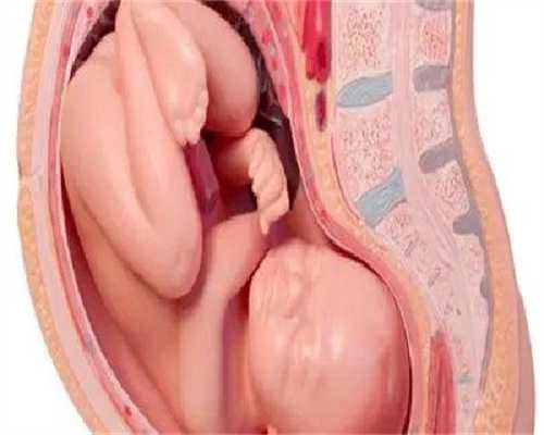 产后子宫恢复：产后不脱发的办法