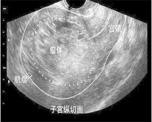 供卵代生生男孩_长沙借卵试管中介,2026长沙三代试管机构收费明细一览表！