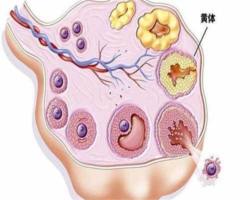 宫颈息肉会影响试管助孕吗