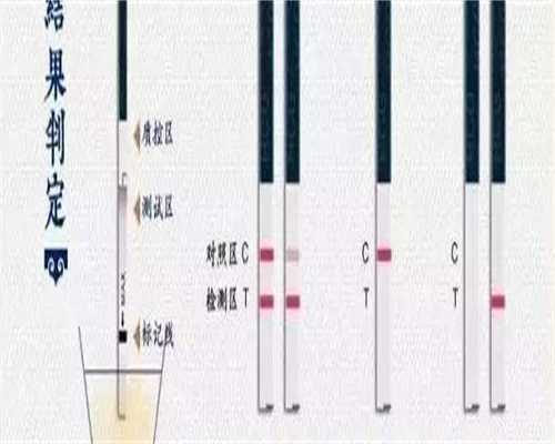 石女有没有子宫和卵巢？