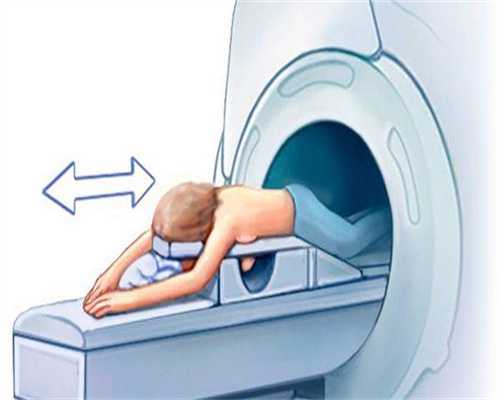 残角合并单角子宫生过一个了？