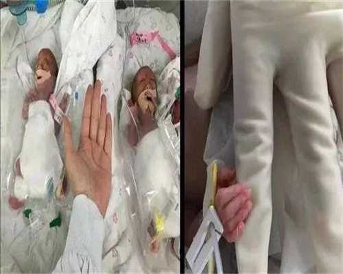 国内代生咨询_有没有权威的代孕机构,试管婴儿费用贵？在ISIDA诊所不存在