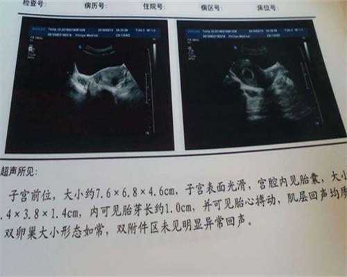 代孕网医院,不孕不育的治疗复杂吗，全面解析！