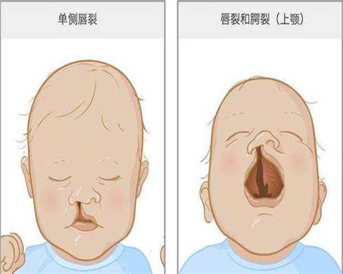培养液三代试管多少钱