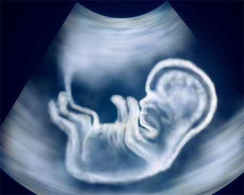 代孕产子服务：2026湖南做试管多少钱？附三代试管费用！