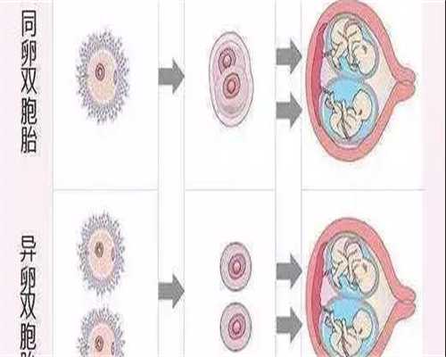 代生孩子公司网_正规的代孕网站,产前运动轻松分娩（产前运动）