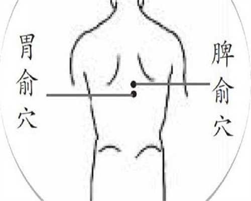 正规代怀费用：女性不孕是否与慢性盆腔炎相关？哪些妇科疾病可能导致不孕？