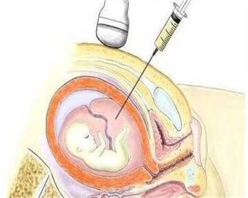 代孕需要血型相同吗_代孕咨询电话,防止宝宝呛奶的方法