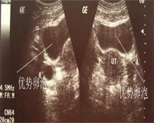 美国试管供卵官网总费用多少钱？试管供卵官网价格公布！